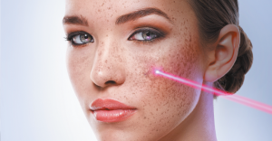 Pigmentation Removal, Causes, Symptoms, and Treatment