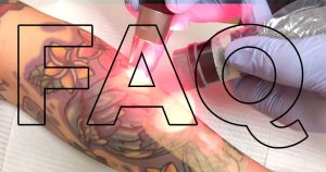 Proper Information About Tattoo Removal, Procedures and Common Faq