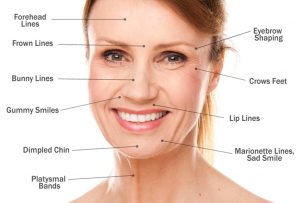 Facial Fillers, Procedures, Post Treatment Guidelines, Faq