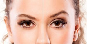 Want to lift your Eyebrows this treatment will Amaze you